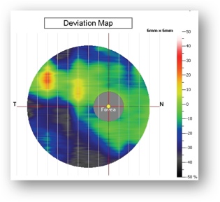 CELULAS GANGLIONARES